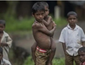 युएसएड बन्द हुदाँ १ करोड ४० लाख बालबालिका भोकमरीमा पर्ने : युनिसेफ