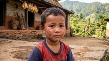 जुम्लामा पाइप बम विस्फोट, एक बालक गम्भीर घाइते, एकजनालाई सामान्य चोट