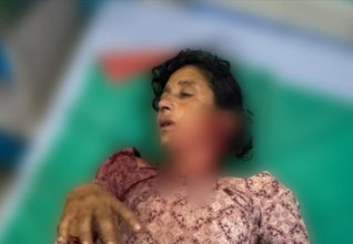बाघको आक्रमणबाट एक महिला घाइते