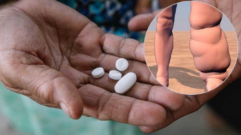 सर्लाहीका १२ पालिकामा फेरि फैलियो हात्तीपाइले